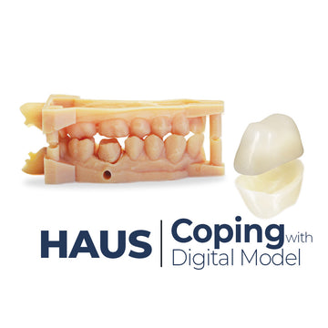 Haus Coping with Digital Model