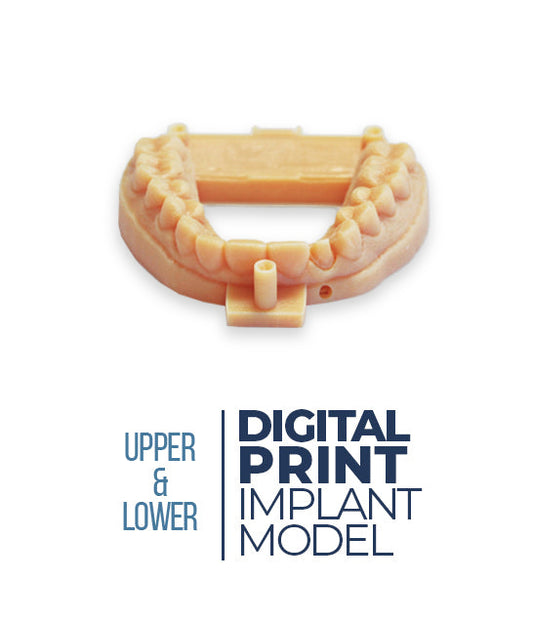 Digital Print Implant Model (Upper & Lower)